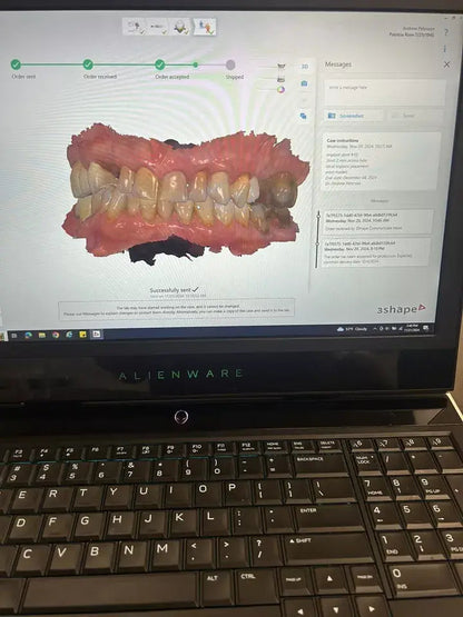 3 Shape Trios Color 3 Pod Dental Intraoral Scanner for CADCAM Dentistry